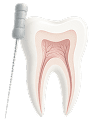 Endodontia